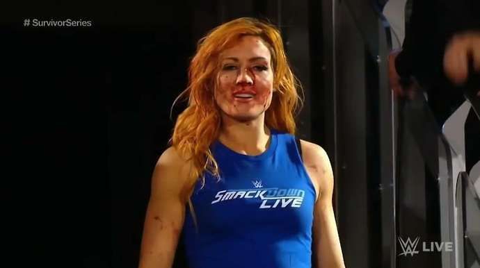 Jax infamously fractured Becky Lynch's face
