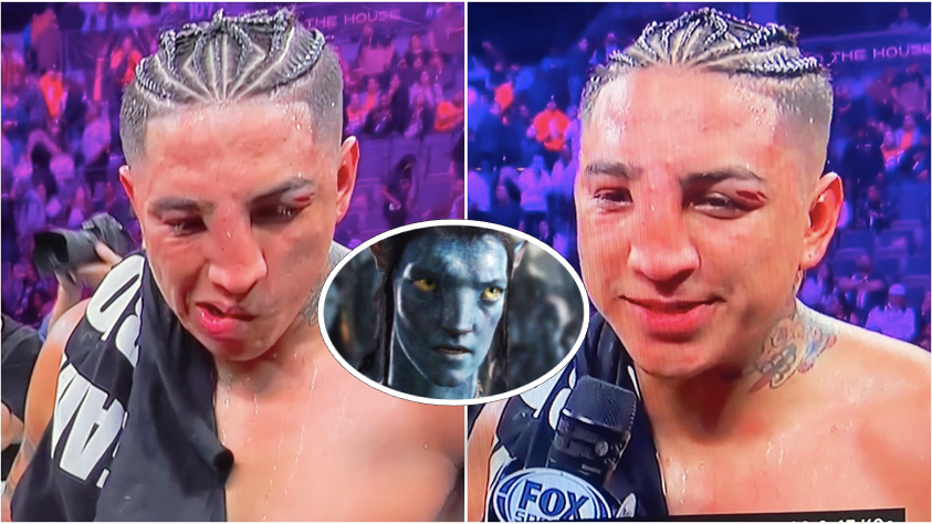 Gruesome boxing injuries: Mario Barrios' battered nose after Keith ...