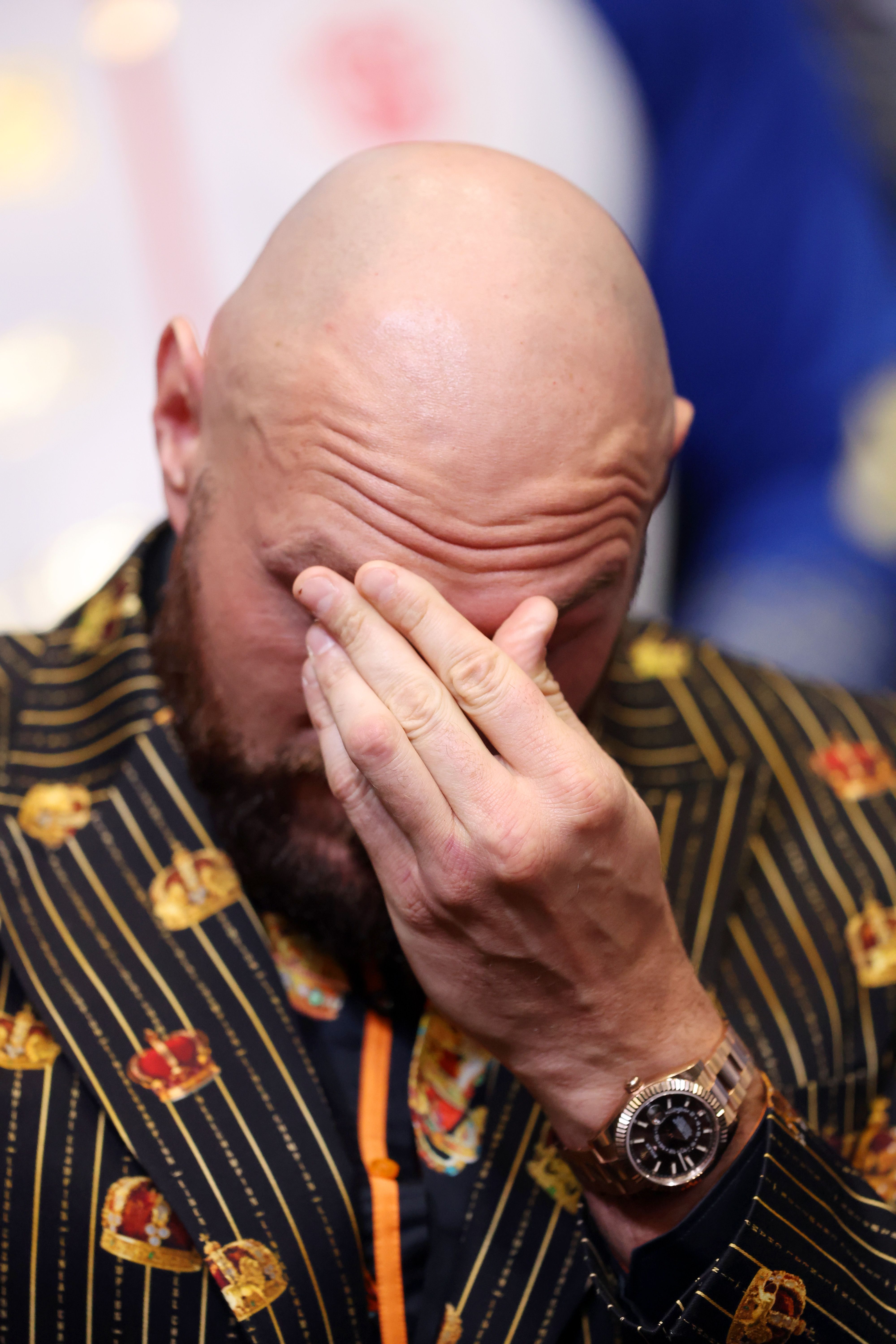 Tyson Fury donned an expensive Rolex for Dillian Whyte press conference 