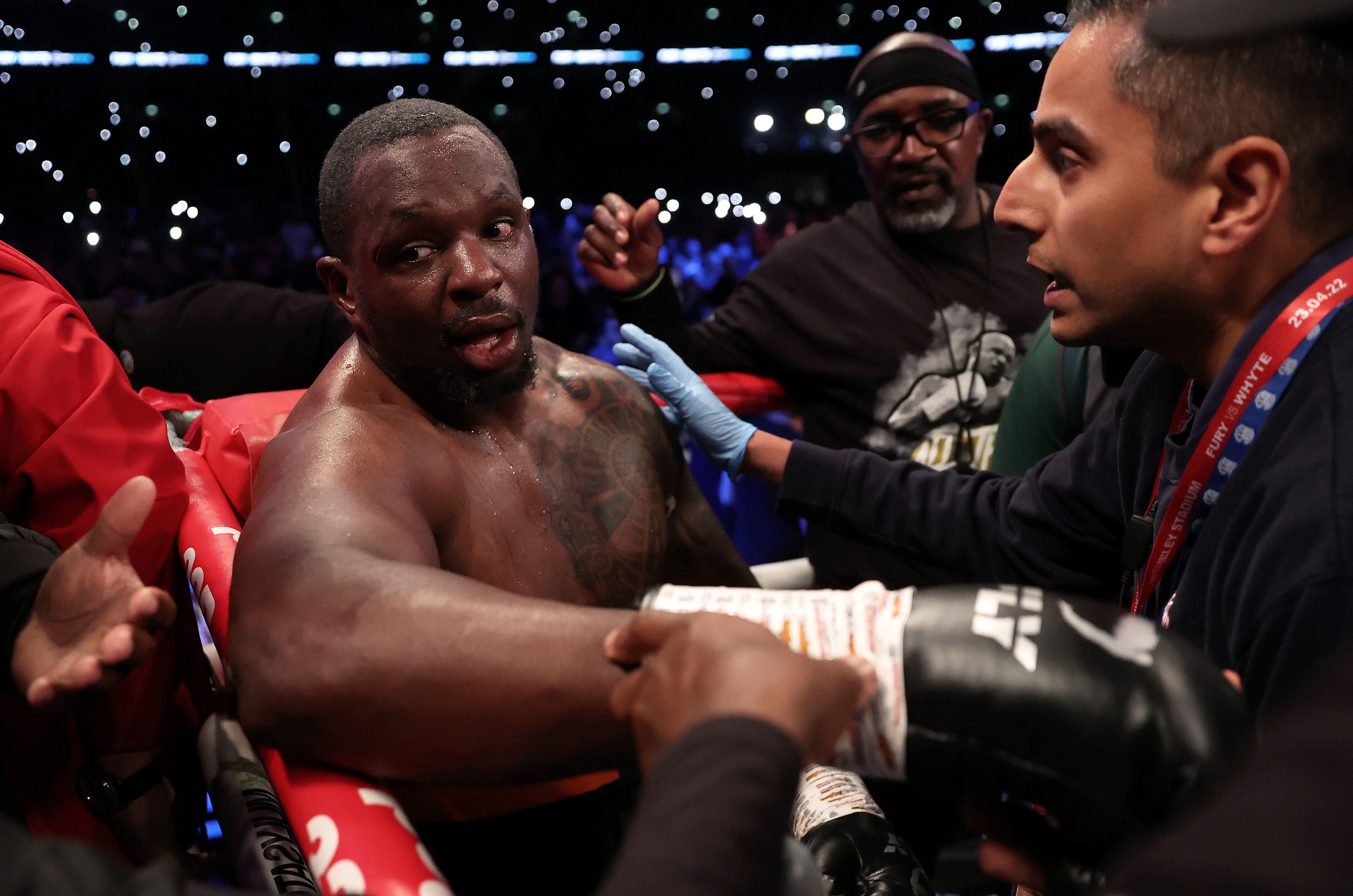 Dillian Whyte not happy with Fury's KO