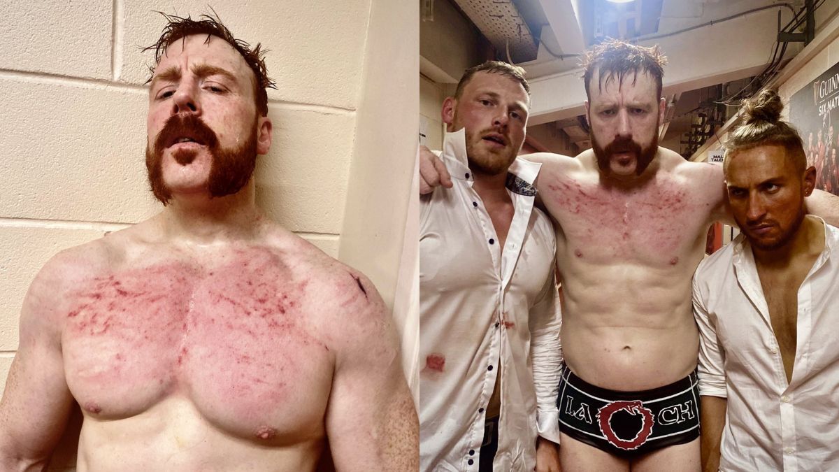 WWE Clash at the Castle: Sheamus' chest looked raw after Gunther