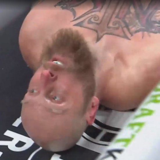 Deontay Wilder: Robert Helenius' face after being knocked out by Bronze Bomber