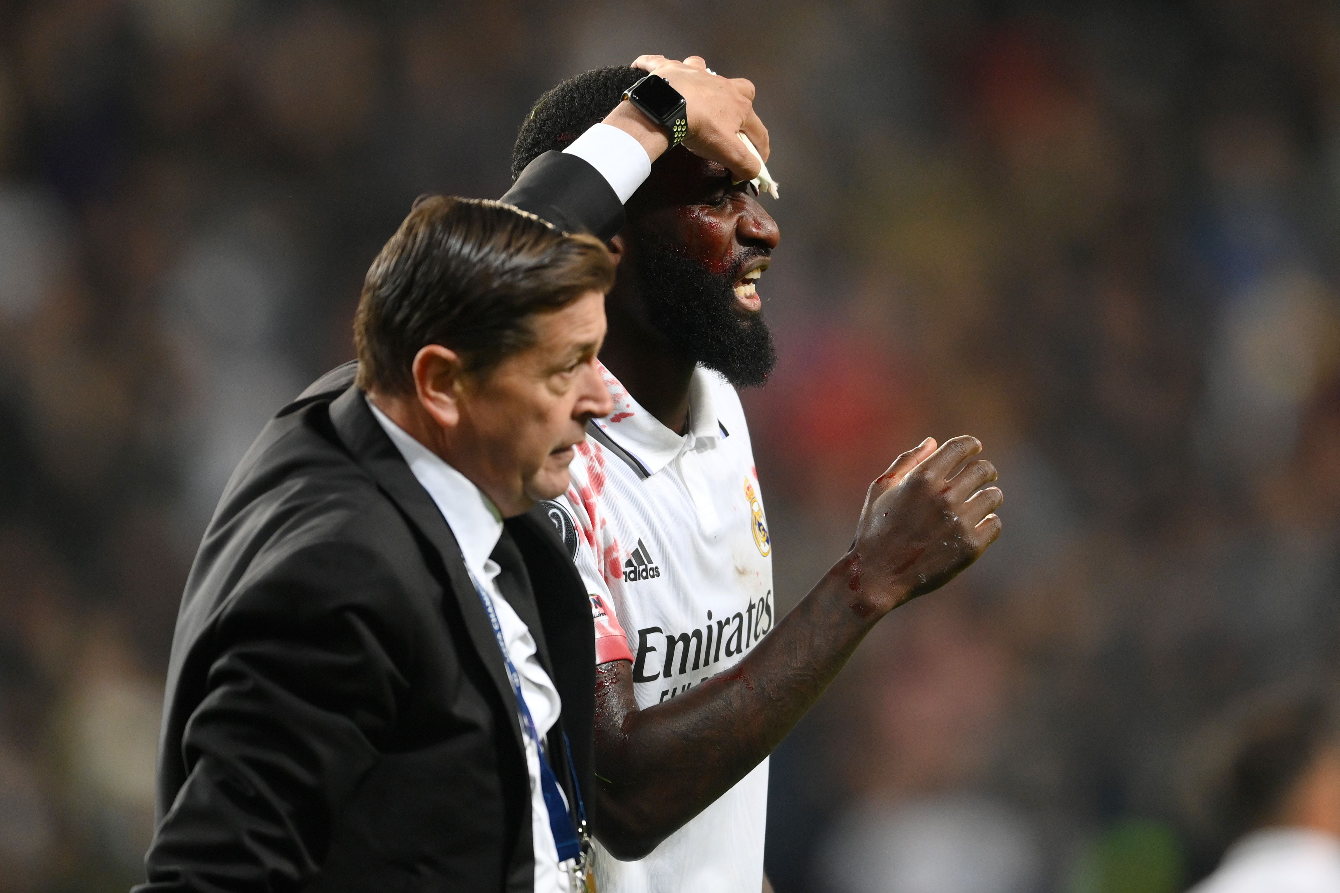 Why is Germany's Antonio Rudiger wearing a face mask at Euro 2020?