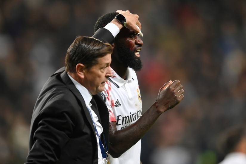 Antonio Rudiger injury: Real Madrid star proves he’s an absolute warrior
