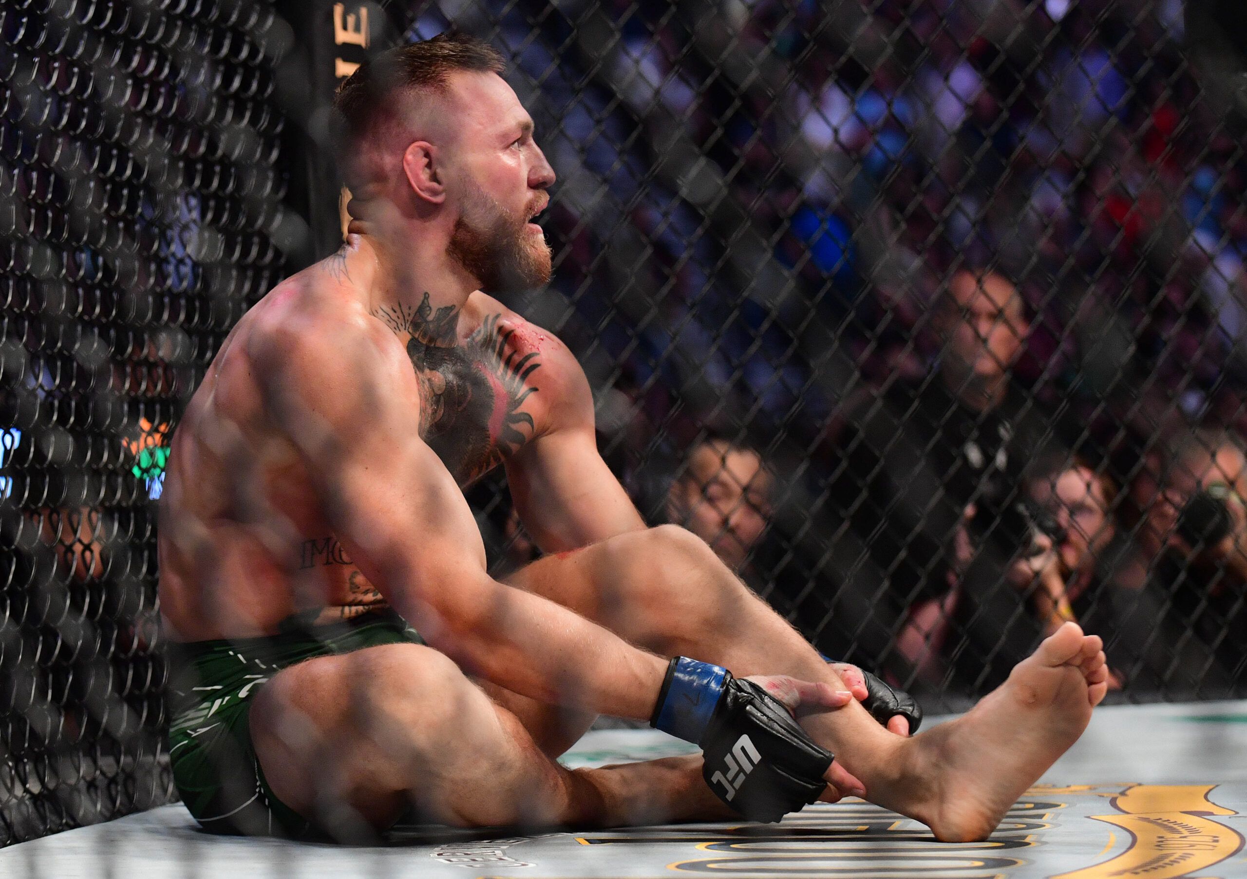 Conor McGregor is still recovering from the horrific broken leg he suffered last July