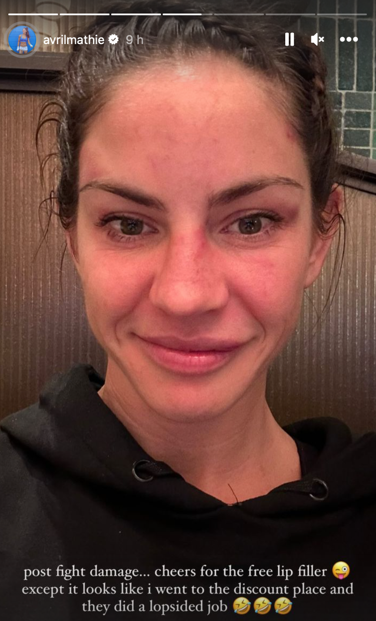 Avril Mathie jokes that Ramla Ali punches gave her 'free lip filler'