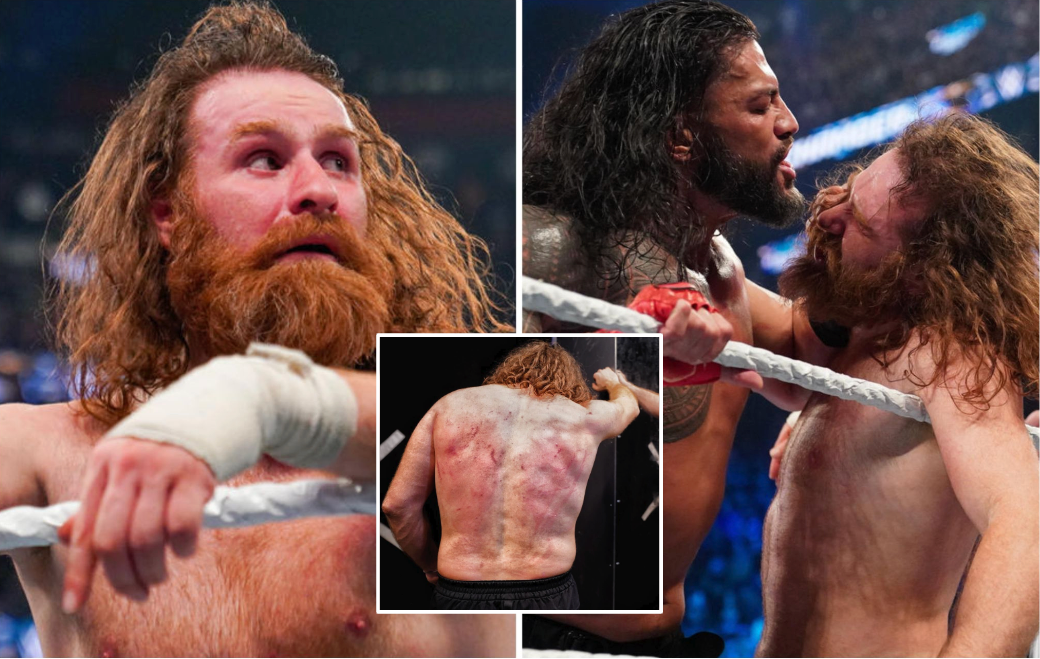 WWE Elimination Chamber Sami Zayn's gruesome injuries from Roman