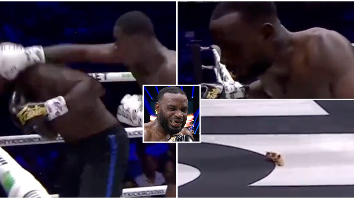 Kickboxer loses entire set of teeth in horrific incident during TKO loss