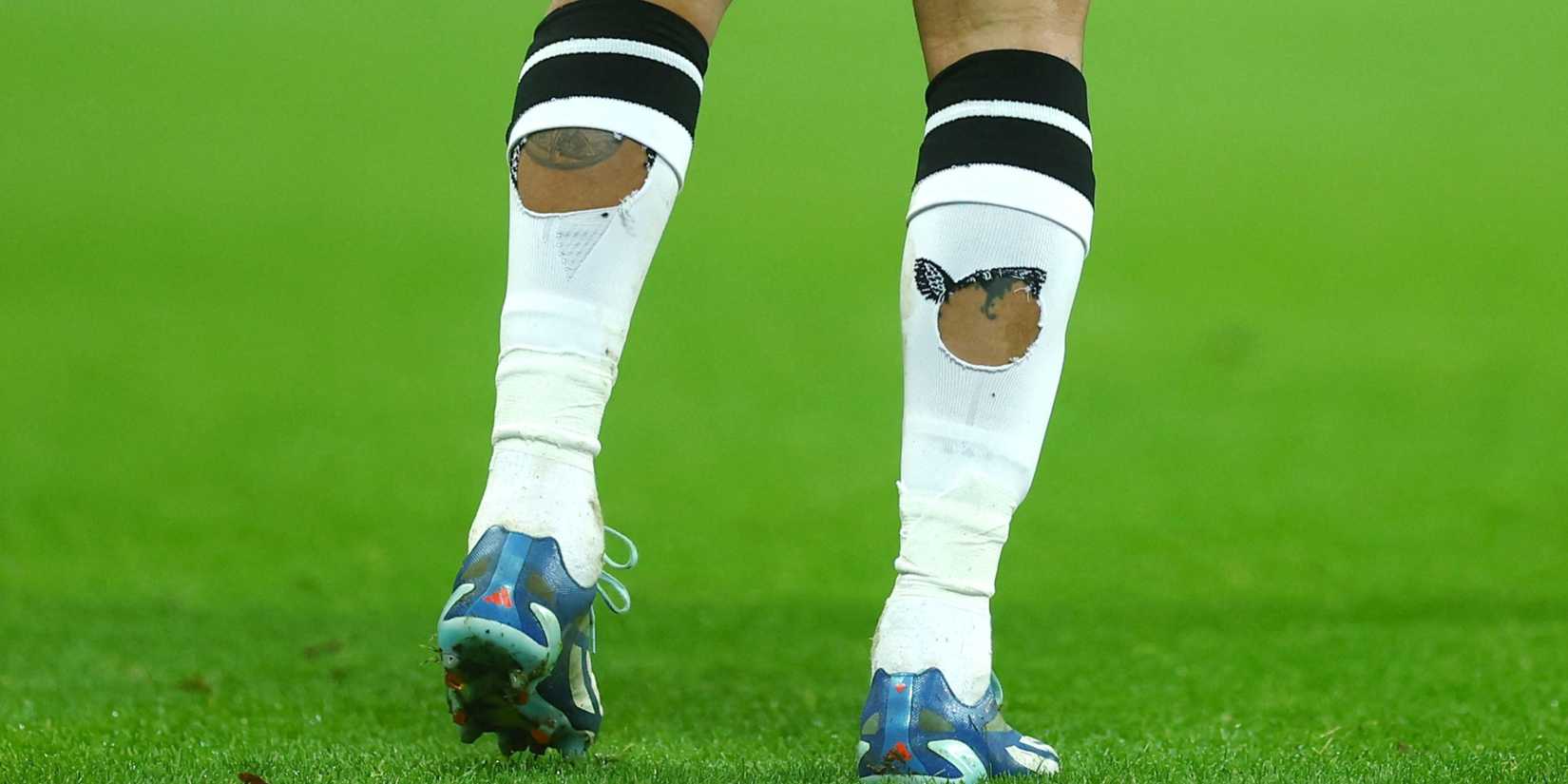 Footballer with holes in socks