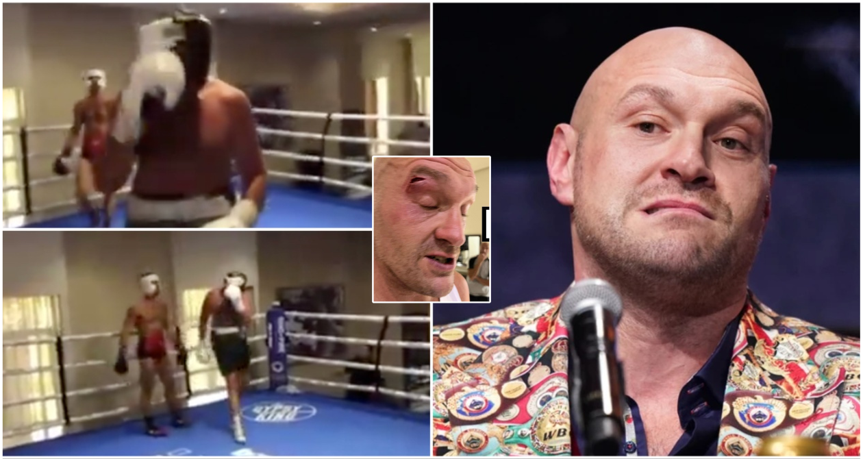 Footage Shows Cut That Caused Tyson Fury Vs Oleksandr Usyk To Be Postponed