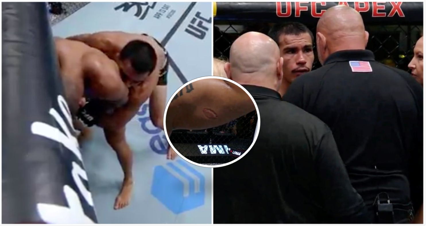 Igor Severino Sacked By Ufc For Biting Opponent Mid Fight 