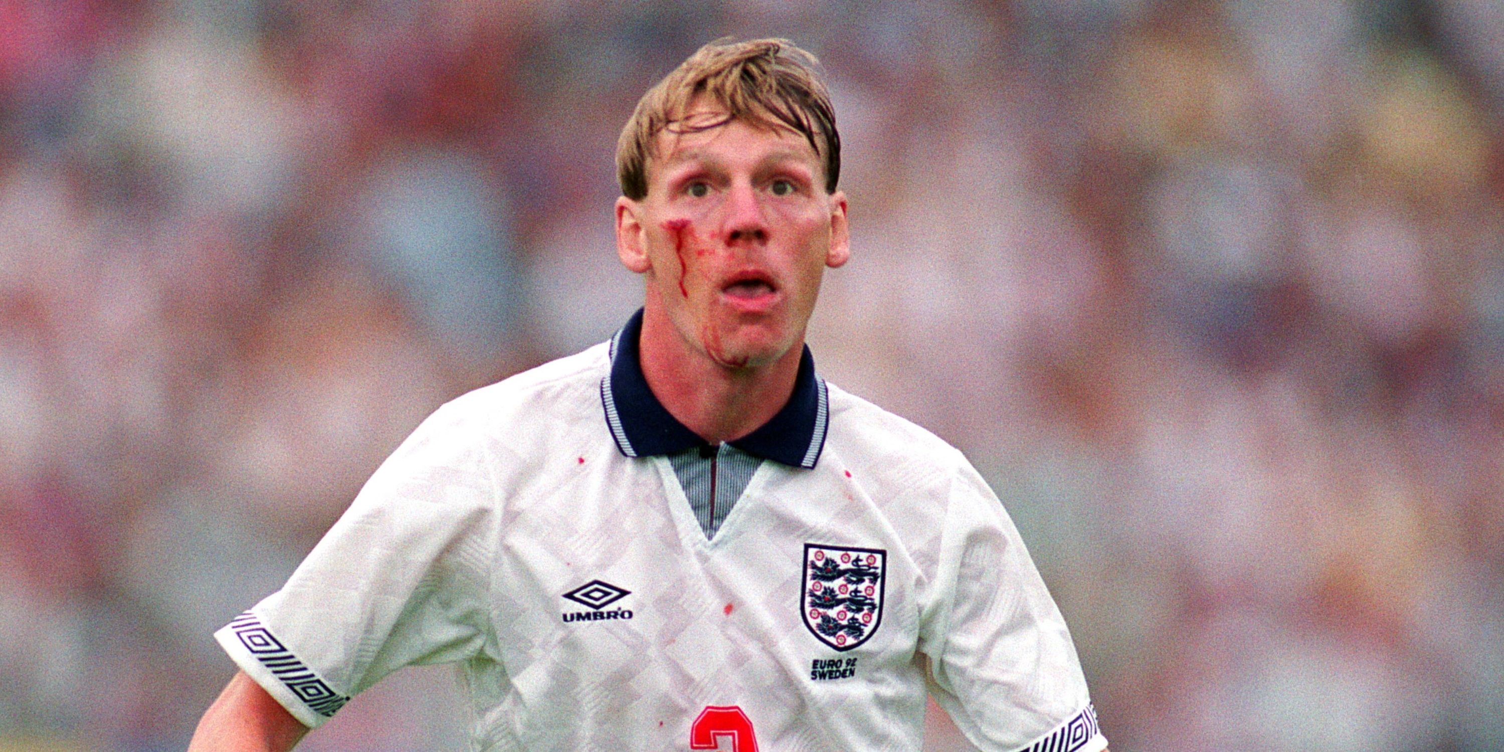 Stuart Pearce bearing the scars of Basile Boli's headbutt at Euro 1992