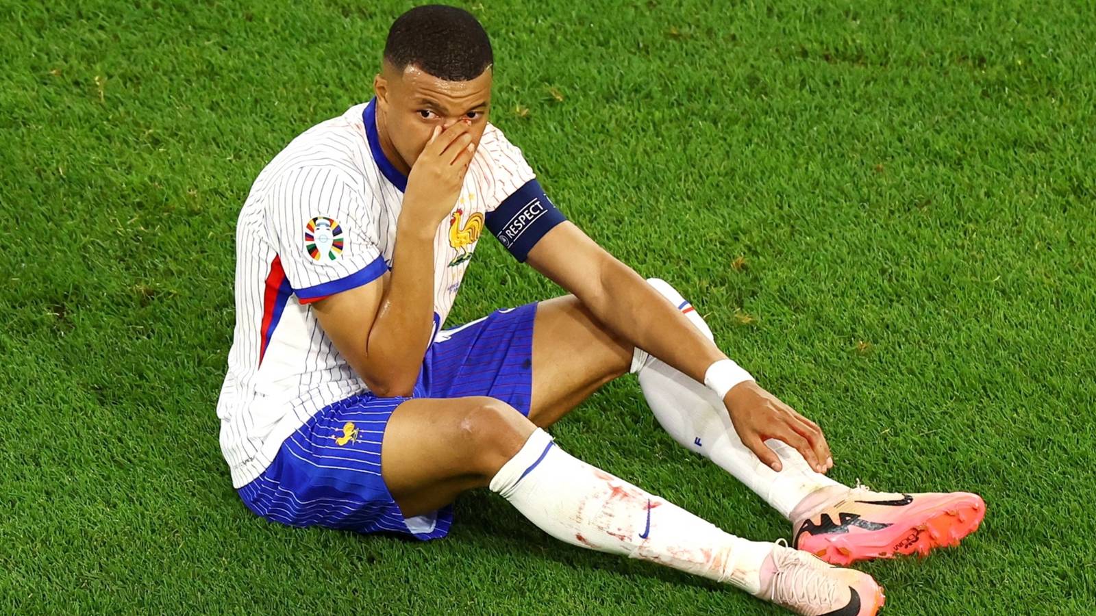 kylian-mbappe-euro-2024-injury-latest-news