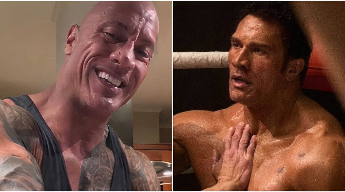 The Rock Suffers Nasty Elbow Injury While Filming UFC-Inspired Movie