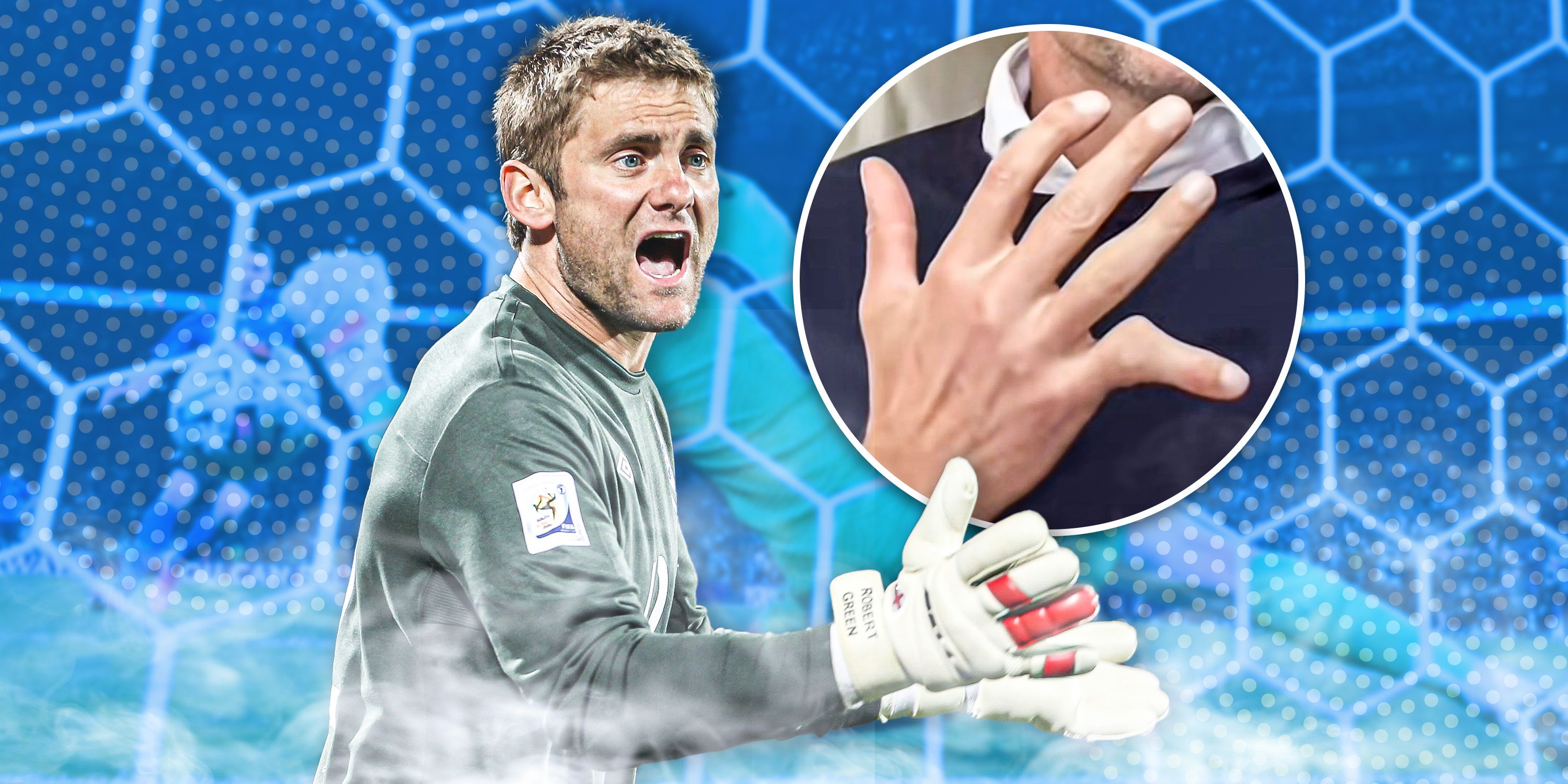 Rob Green Explains The Story Behind His Injured Little Finger