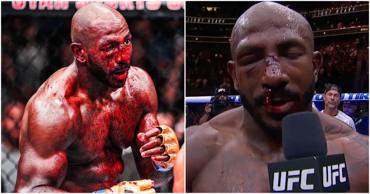 What Khalil Rountree's Face Looked Like 24 Hours After Bloody Alex ...