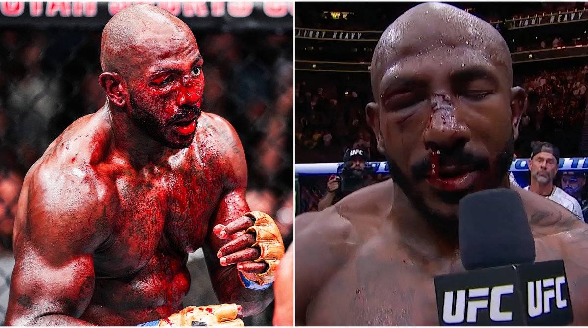 What Khalil Rountree's Face Looked Like 24 Hours After Bloody Alex ...