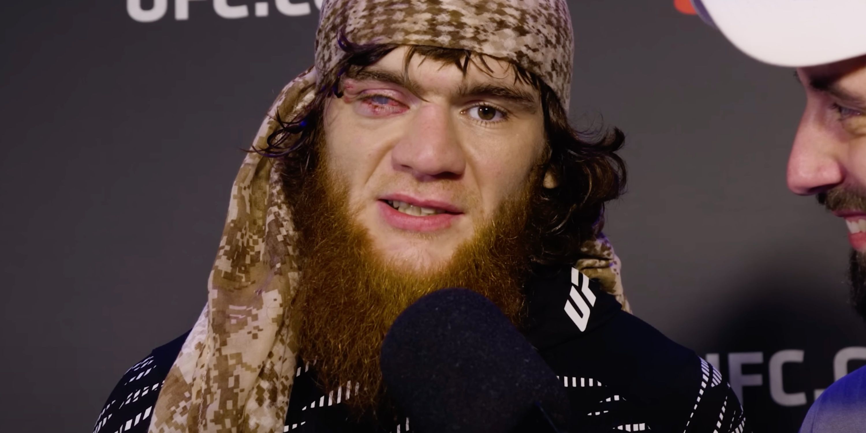 What Sharaputdin Magomedov Looked Like Before he Went Blind in One Eye