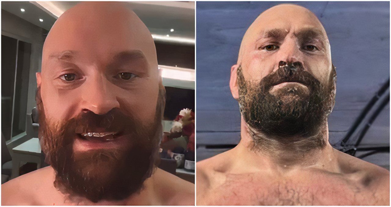 Tyson Fury's Current Physique Ahead of Oleksandr Usyk Rematch