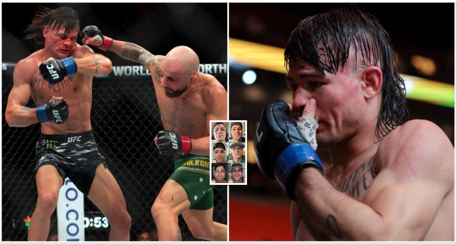 Diego Lopes Shows Off Facial Scars 6 Days After Fighting Alexander Volkanovski at UFC 314