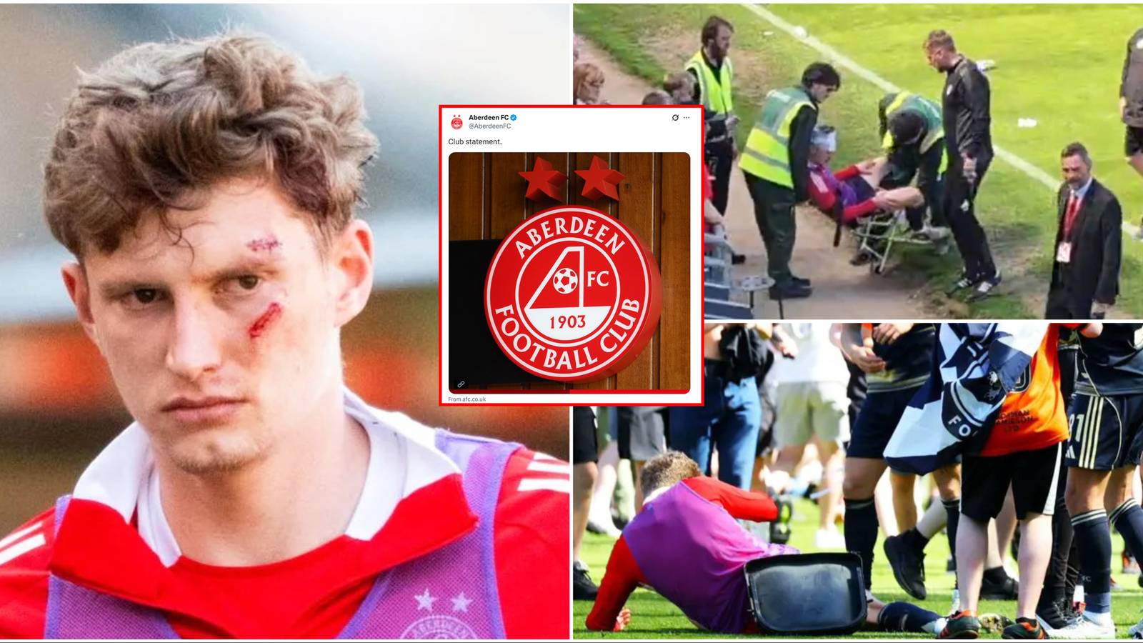 Aberdeen Slam Actions From Fans That Left Player With a ‘Serious Facial ...
