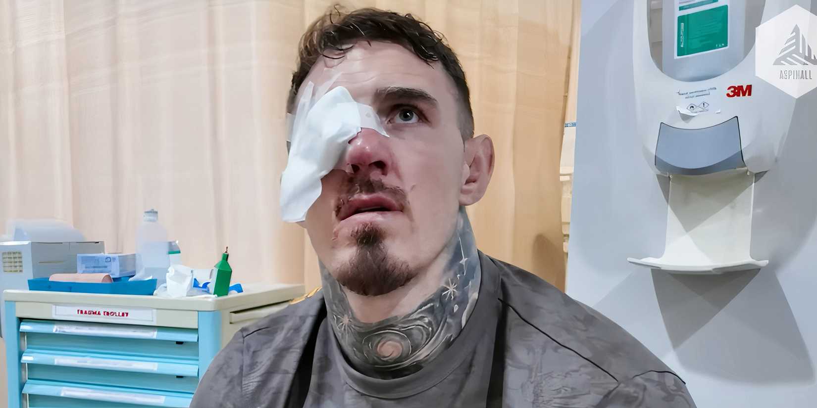 Tom Aspinall with his eye patch