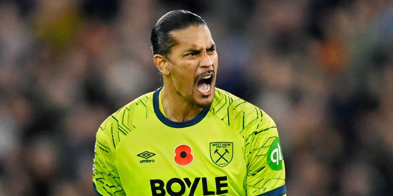 alphonse areola