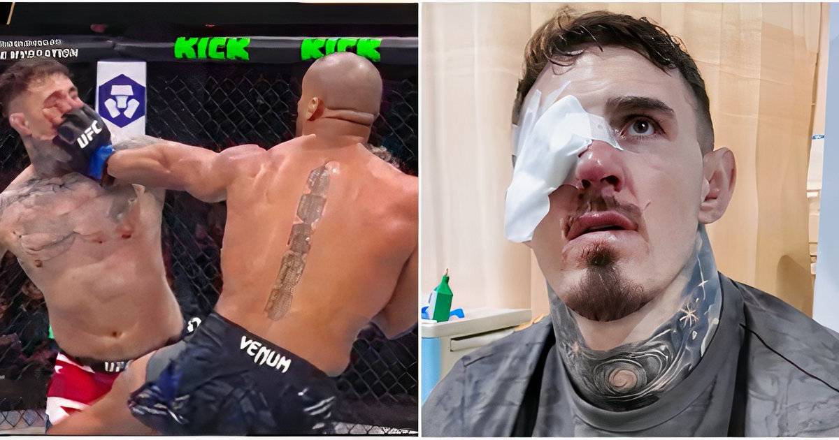 Tom Aspinall Releases Medical Report on Eye Injury Behind UFC 321 Stoppage