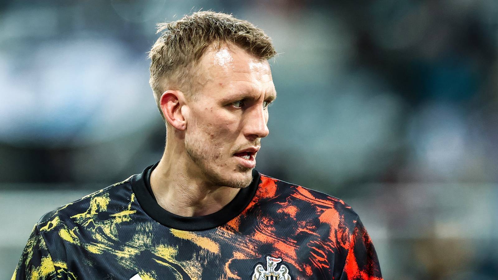 Dan Burn's Ankle Recovery Hits Major Setback