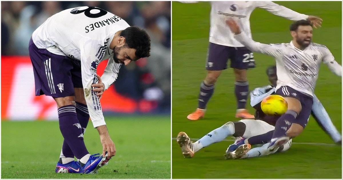 Every Man Utd Game Bruno Fernandes is Set to Miss Through Injury