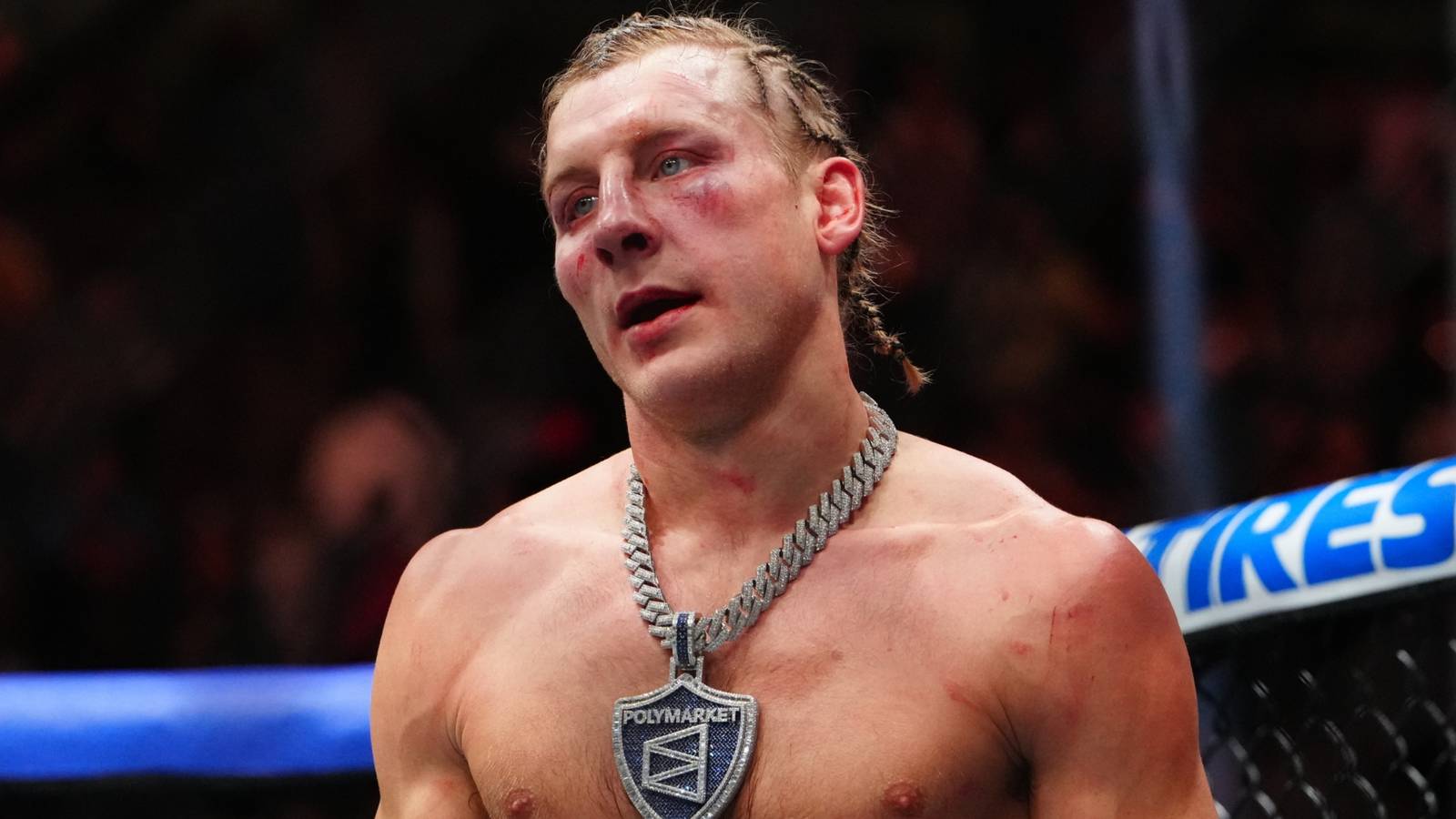UFC 324: Paddy Pimblett Gives Powerful Post-Fight Speech About Men's Mental Health