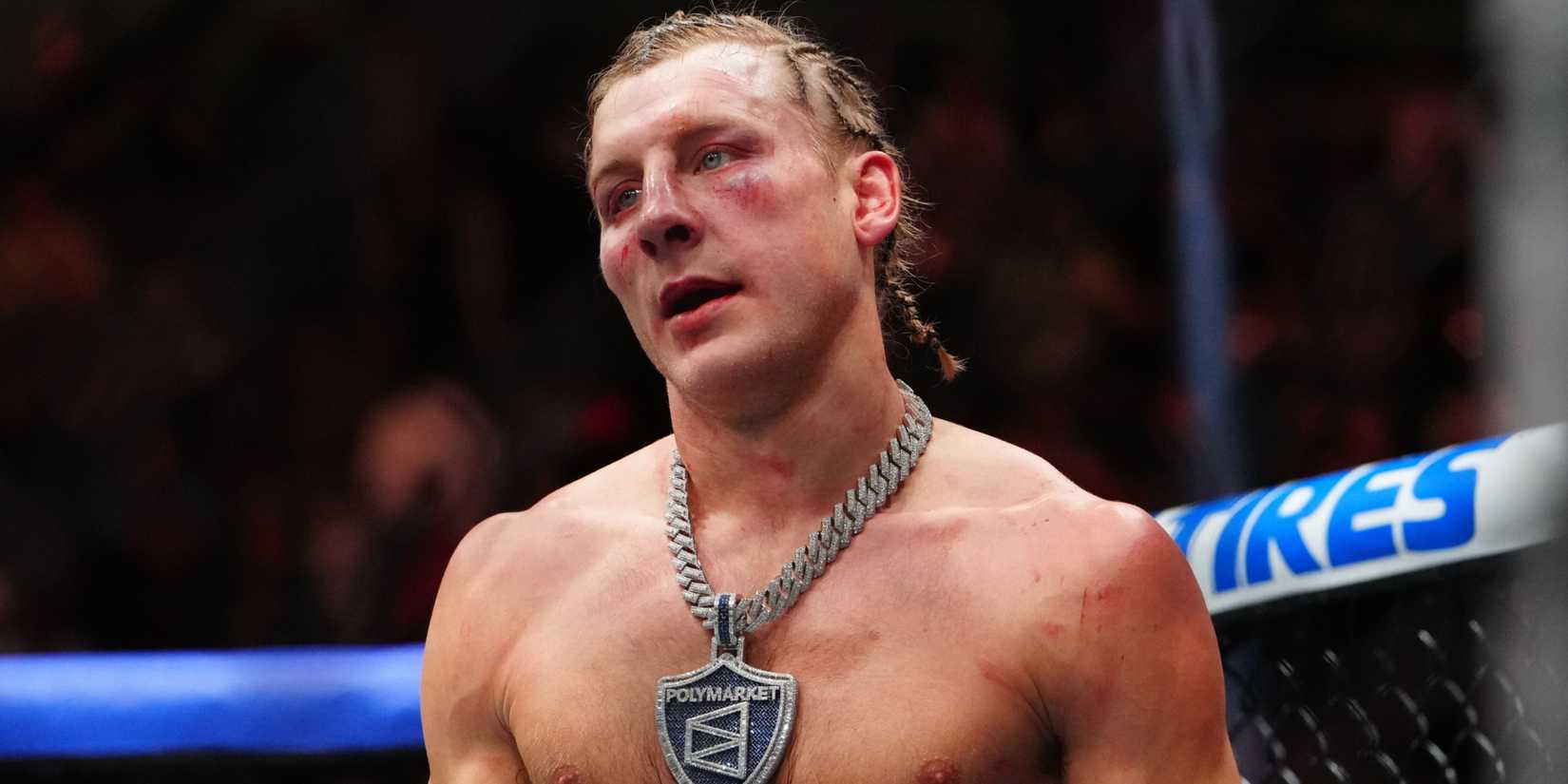 Paddy Pimblett's Face Weeks After UFC 324 Revealed During Eating Frenzy