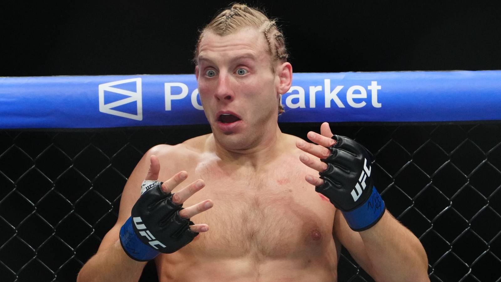 Paddy Pimblett: Photo of His Face Few Days After Justin Gaethje Fight