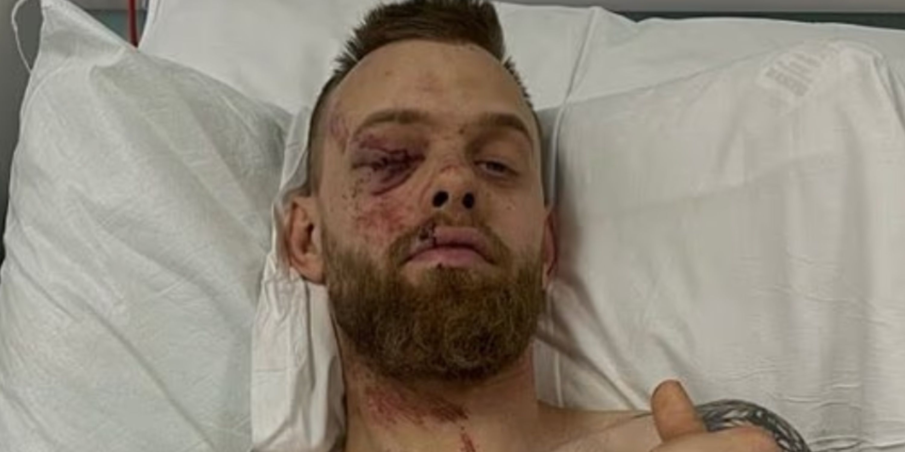 Speedway: Tobias Thomsen Left With Horror Injuries After Sickening Crash