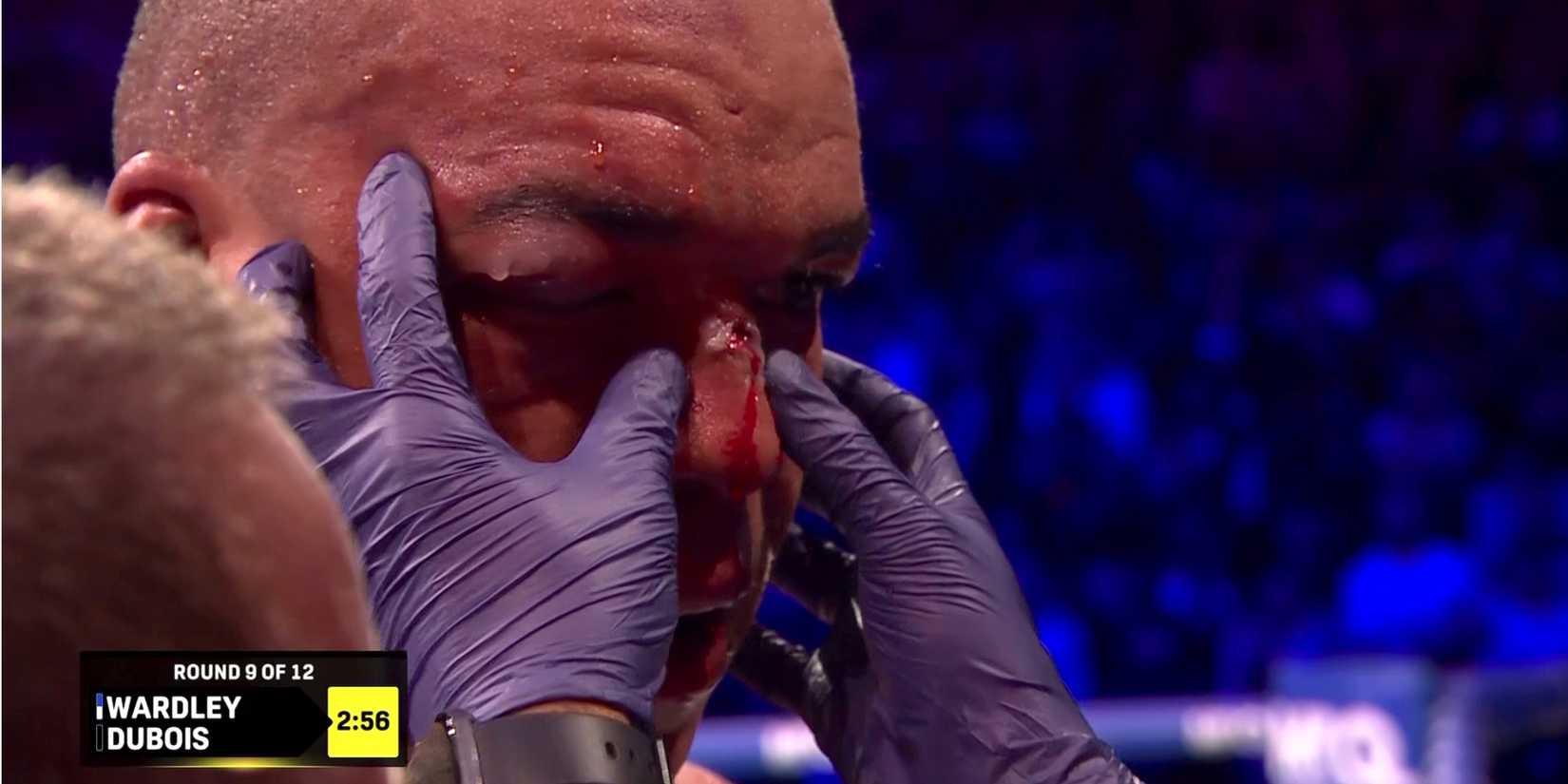 Fabio Wardley during Daniel Dubois fight