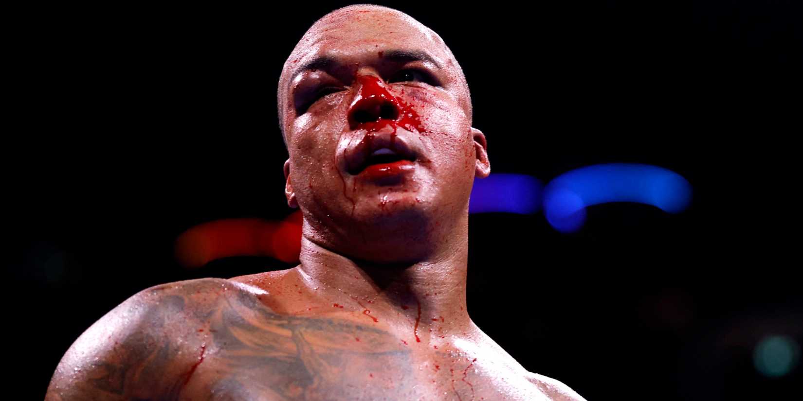 Daniel Dubois vs Fabio Wardley 2: Full Fight Salaries Revealed