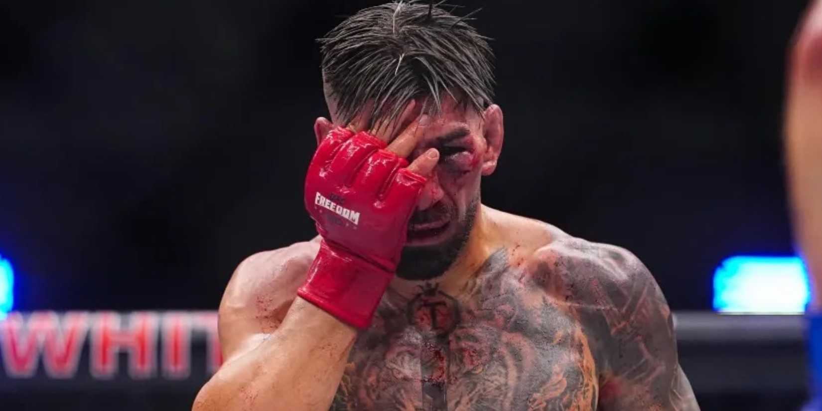 Ilia Topuria injured eye