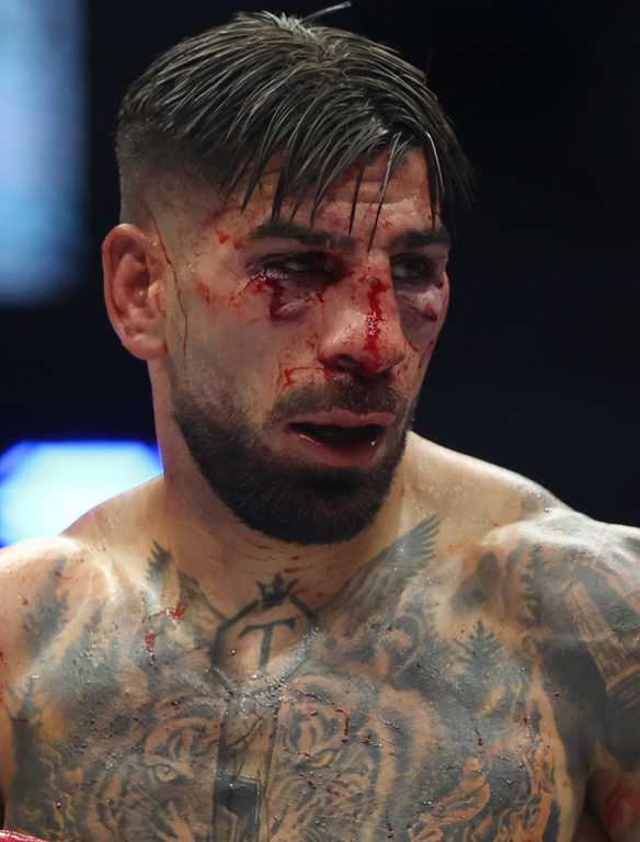 Topuria Cleared to Fight, Blames Gaethje's Gloves